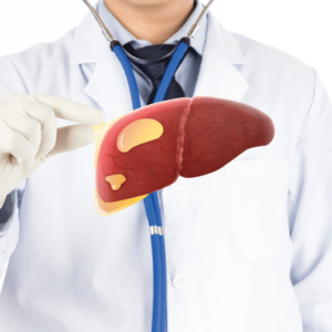 Fatty Liver Screening Package (NASH Screening)