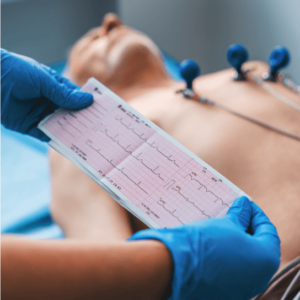 Electrocardiogram (ECG)
