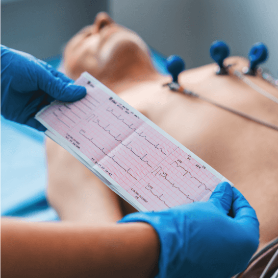 Electrocardiogram (ECG)