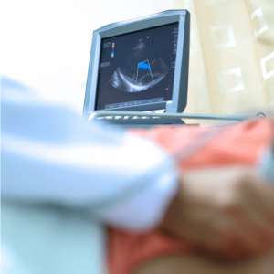 Echocardiography (Echo)