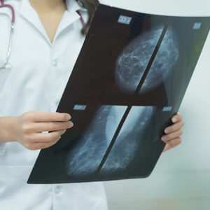 Mammography