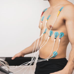 TMT Test (Treadmill / Cardiac Stress Test) – RxDx Clinics Bangalore